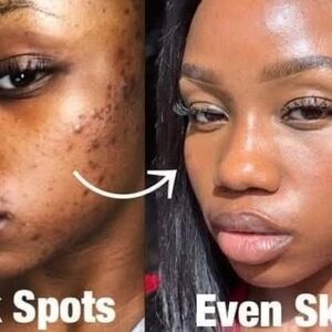 Black Spot Corrector -3 pieces